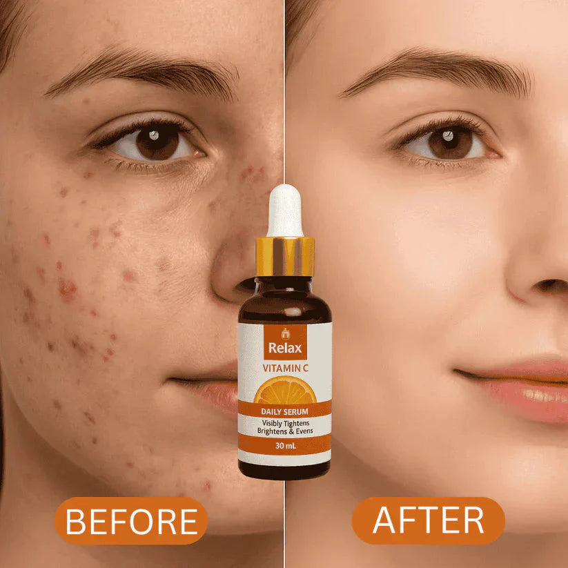Relax UK Vitamin C Serum (Original)
