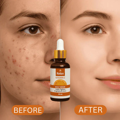 Relax UK Vitamin C Serum (Original)